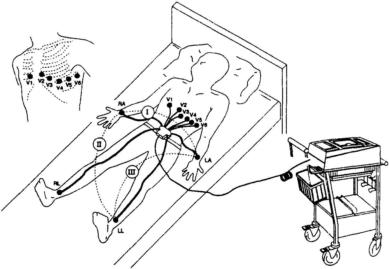 心电监护电极贴放位置 医学小常识-吾尊时尚