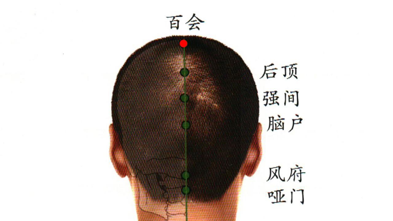 百会穴的准确位置图和作用 此穴为督脉经络上的重要穴道之一