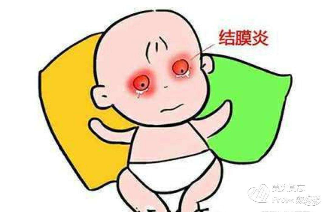 眼睛疼是怎么回事 眼睛疼怎么办