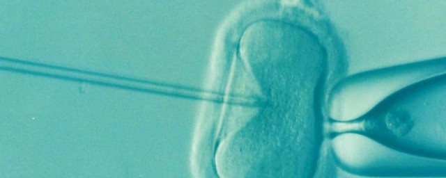 体外受精是指什么如何，体外受精是指什么可以吗